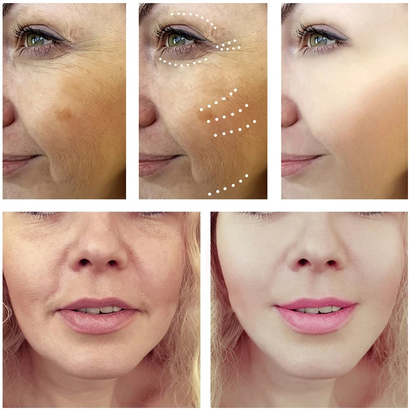 Koninklijke Draak Bloed Serum  - Placenta Extract Serum recensie en prijs